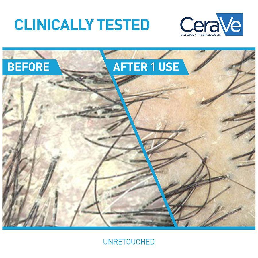 CeraVe Hydrating 2in1 Anti-Dandruff Shampoo + Conditioner, Sulfate & Paraben Free Fragrance Free