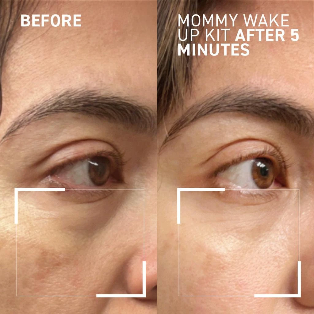 Dr. Brandt Skincare Mommy Wake Up Kit 6