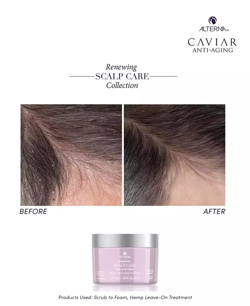 ALTERNA Renewing Scalp Care Scrub To Foam, 6 oz. 3