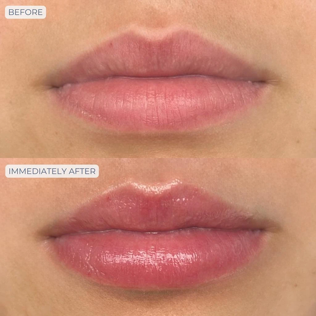 Dr. Whitney Bowe Beauty Dr. Whitney Bowe Beauty Tri-Liptide Peptide Lip Enhancing Treatment 15ml 3