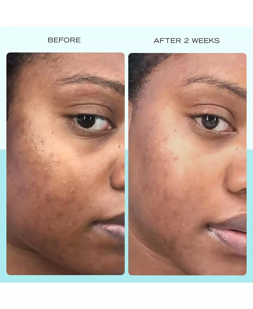 First Aid Beauty Dark Spot Serum With Niacinamide, 1 oz. 12