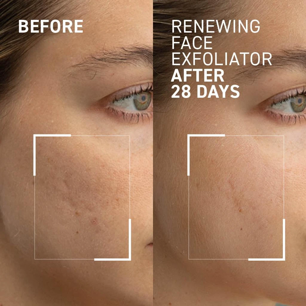 Dr. Brandt FACE EXFOLIATOR 3