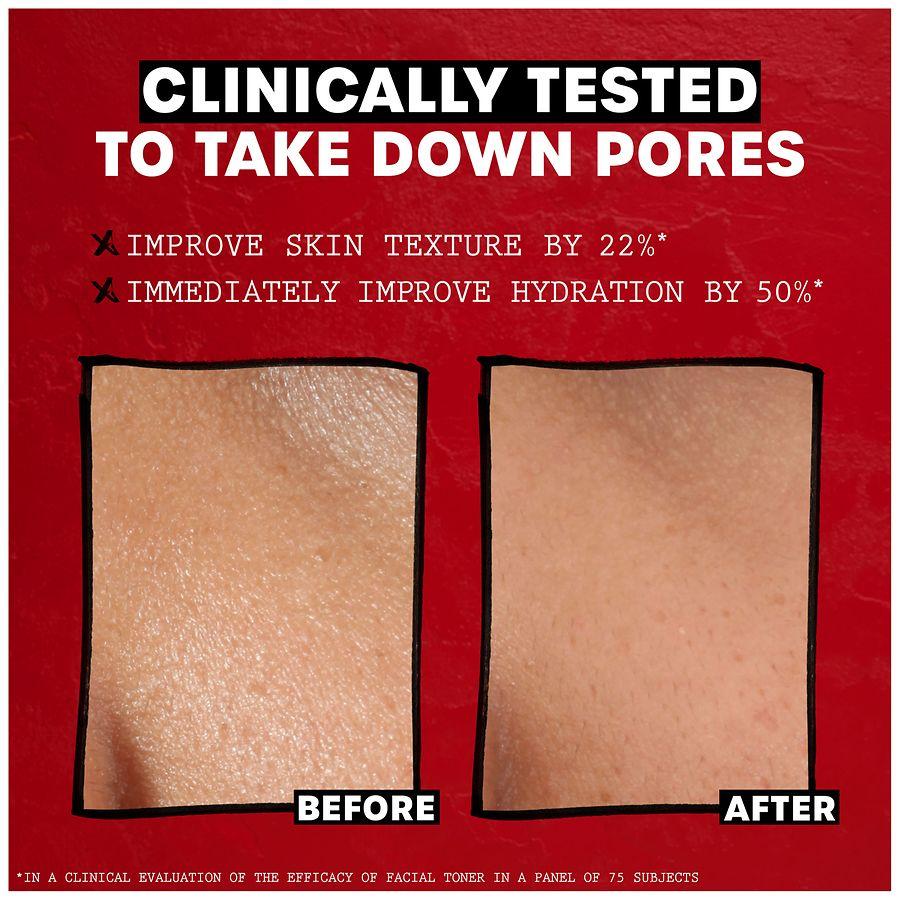 Thayers Trial Size Witch Hazel Facial Mist with Aloe Vera Toner Rose Petal, Rose Petal