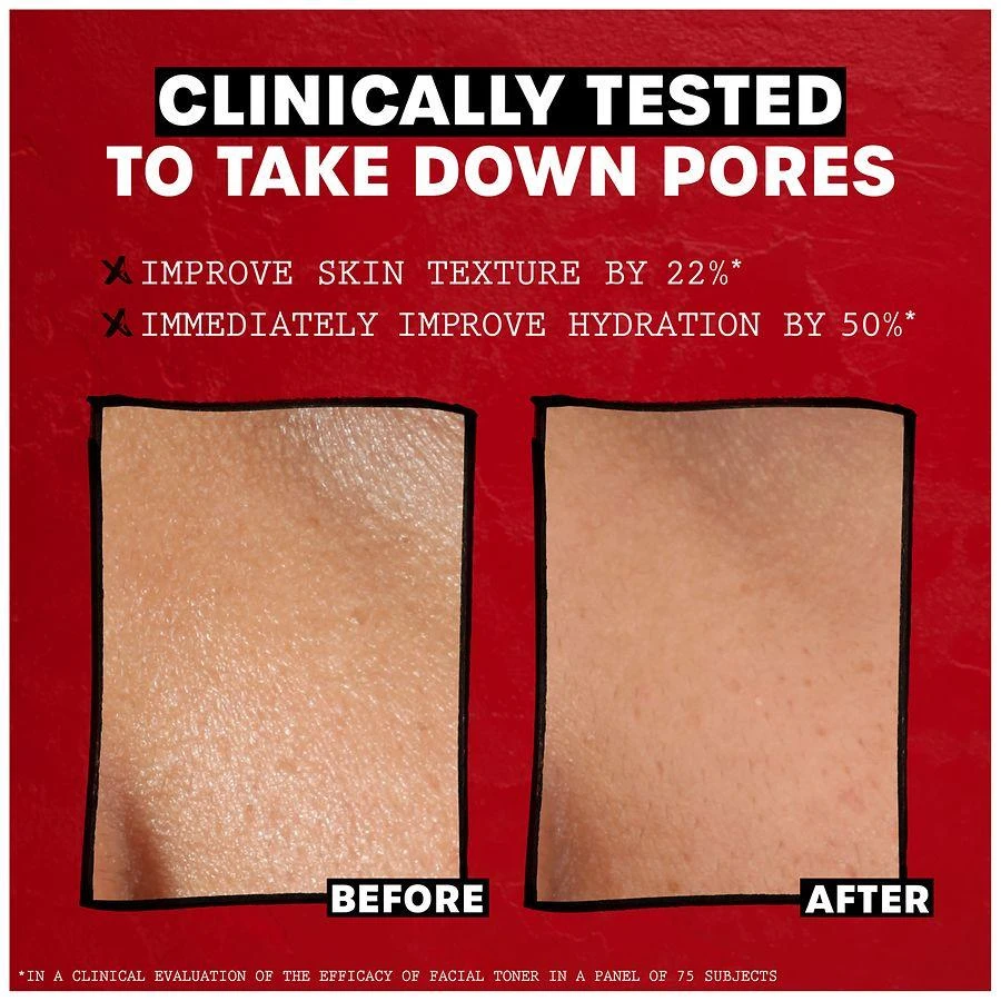 Thayers Witch Hazel Toner With Aloe Unscented 5