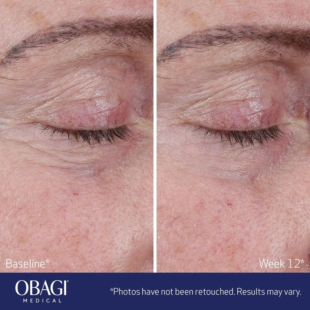 Obagi Medical Obagi Medical ELASTIderm Advanced Filler Concentrate 5