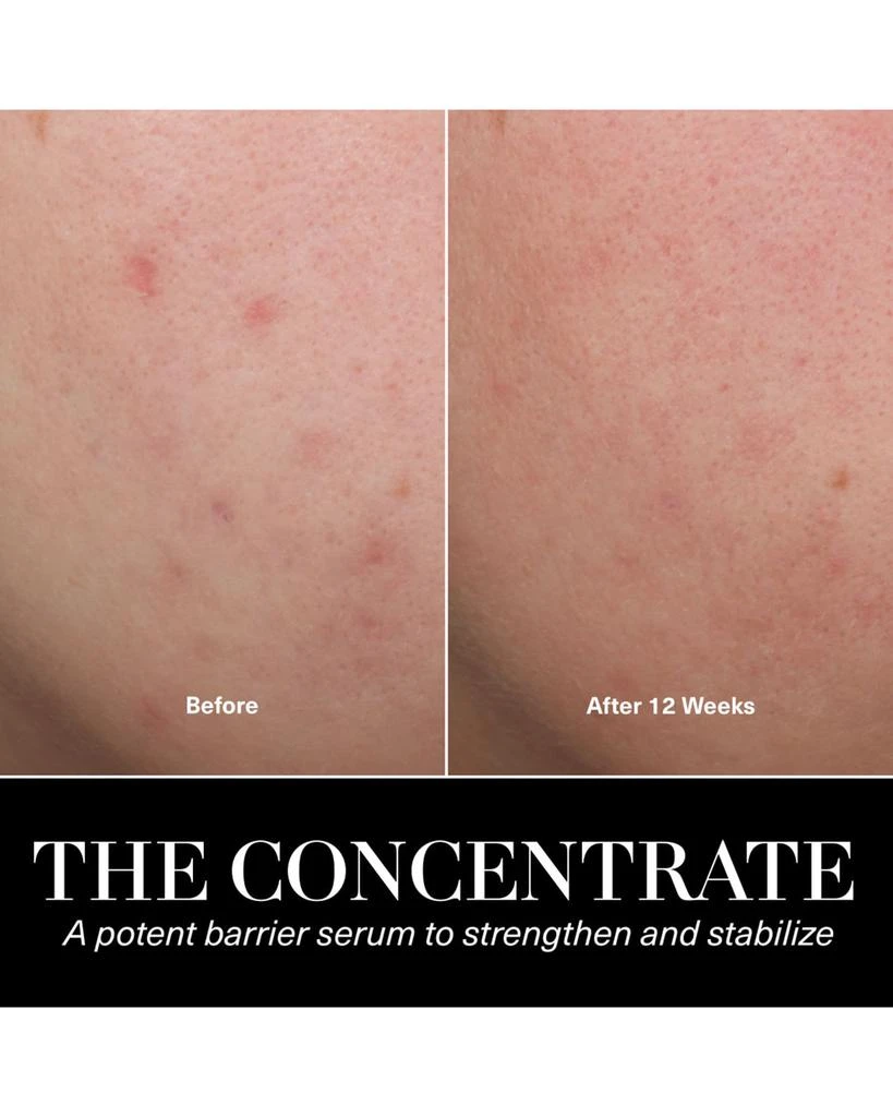 La Mer The Concentrate - Soothing & Strengthening Face Serum 9