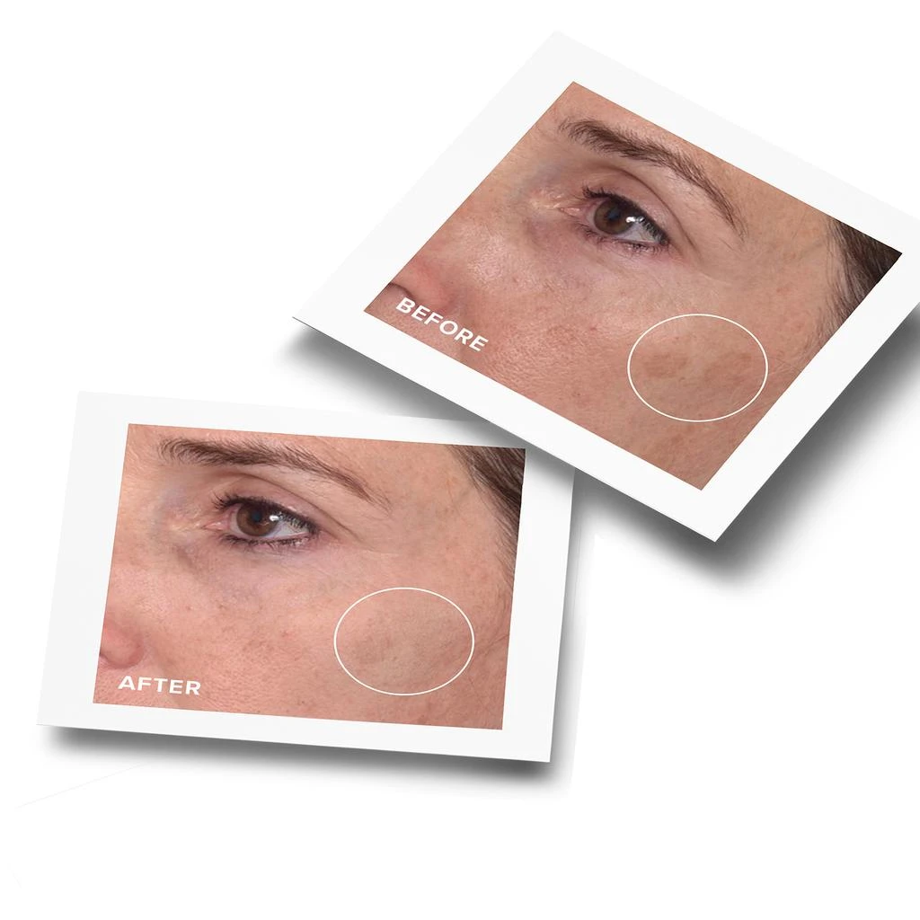 Murad Rapid Dark Spot Correcting Serum 7