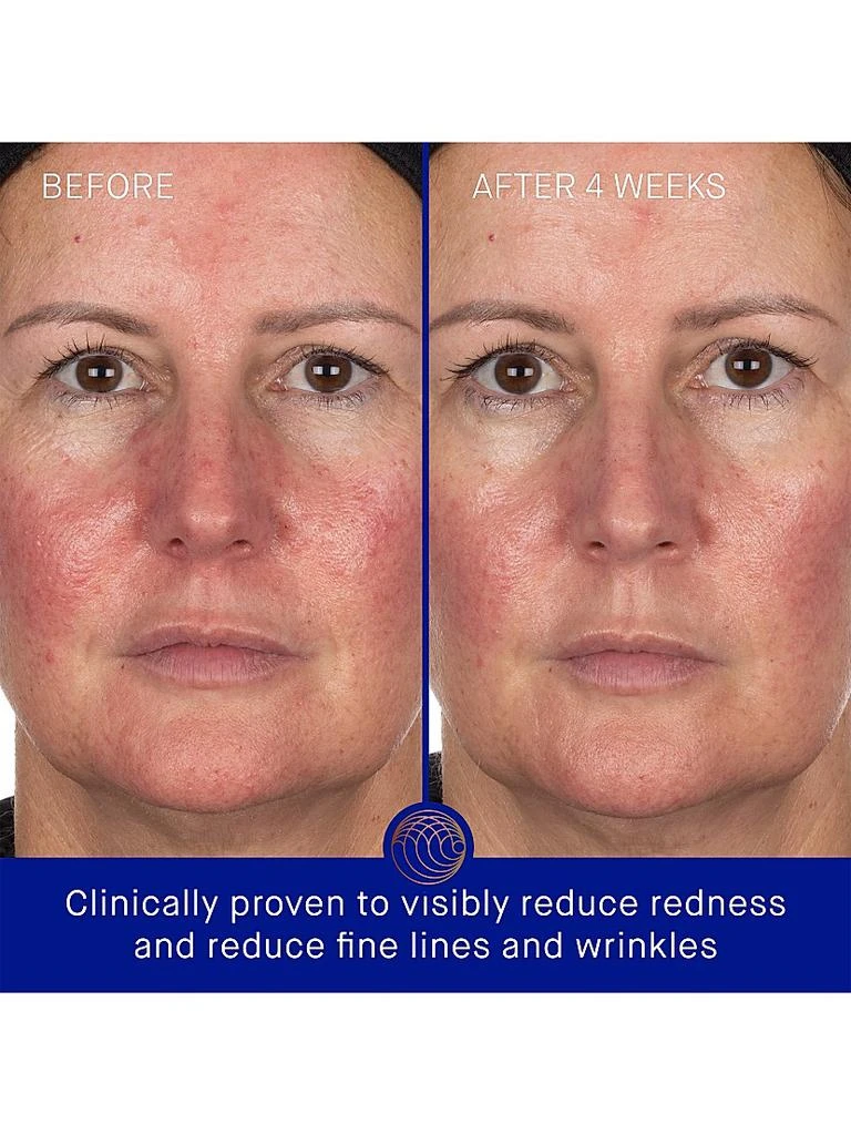 Augustinus Bader The Hydrogel Face Mask 3