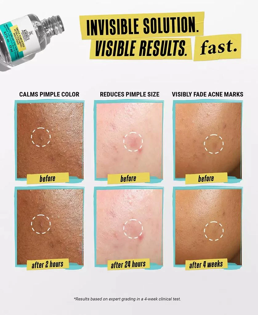 Kiehl's Truly Targeted Acne-Clearing Solution 8