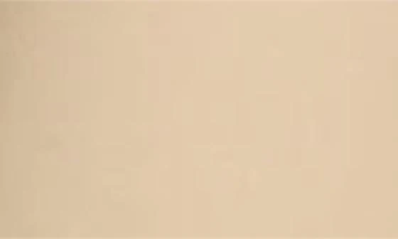 Vince Cotton Utility Trench Coat 4