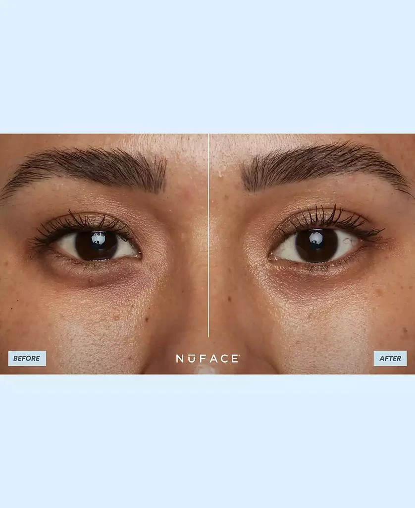 NuFace IonPlex® Power Patches - Brightening 
Firming Eye Masks 4