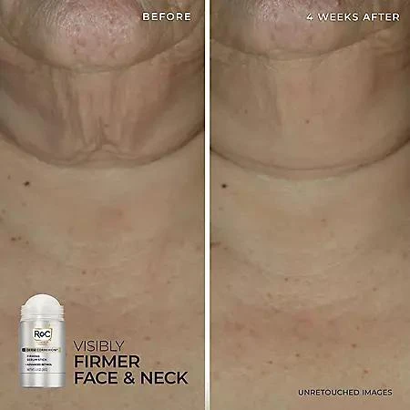RoC RoC Derm Correxion Firming Serum Stick and Contour Cream Kit 4