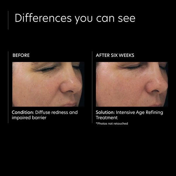 PCA SKIN PCA SKIN Intensive Age Refining Treatment 0.5 Percent Pure Retinol Night 4