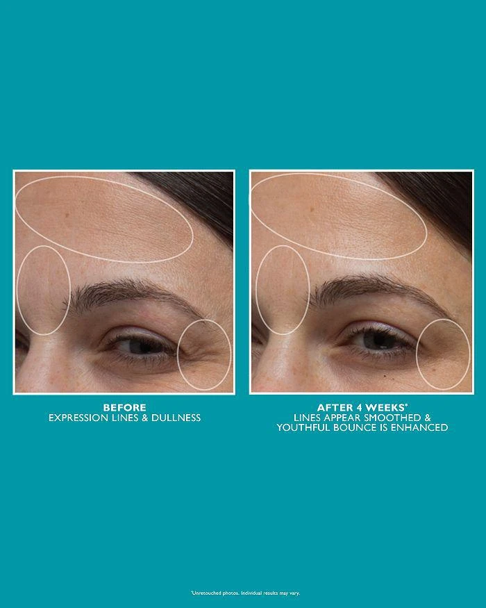 Peter Thomas Roth Full Size Peptide Skinjection Stars Line-Smoothing Kit ($120 value) 7
