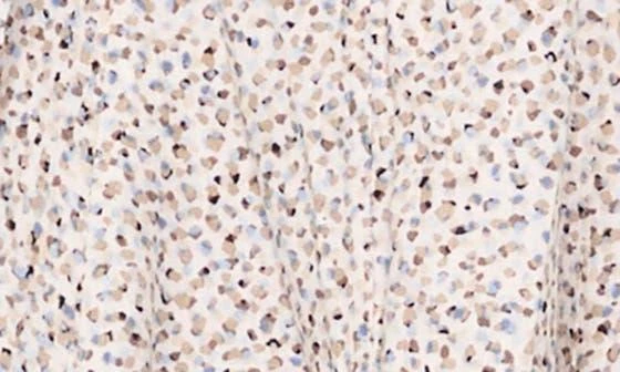 Vince Camuto Abstract Print Off the Shoulder Dress 4