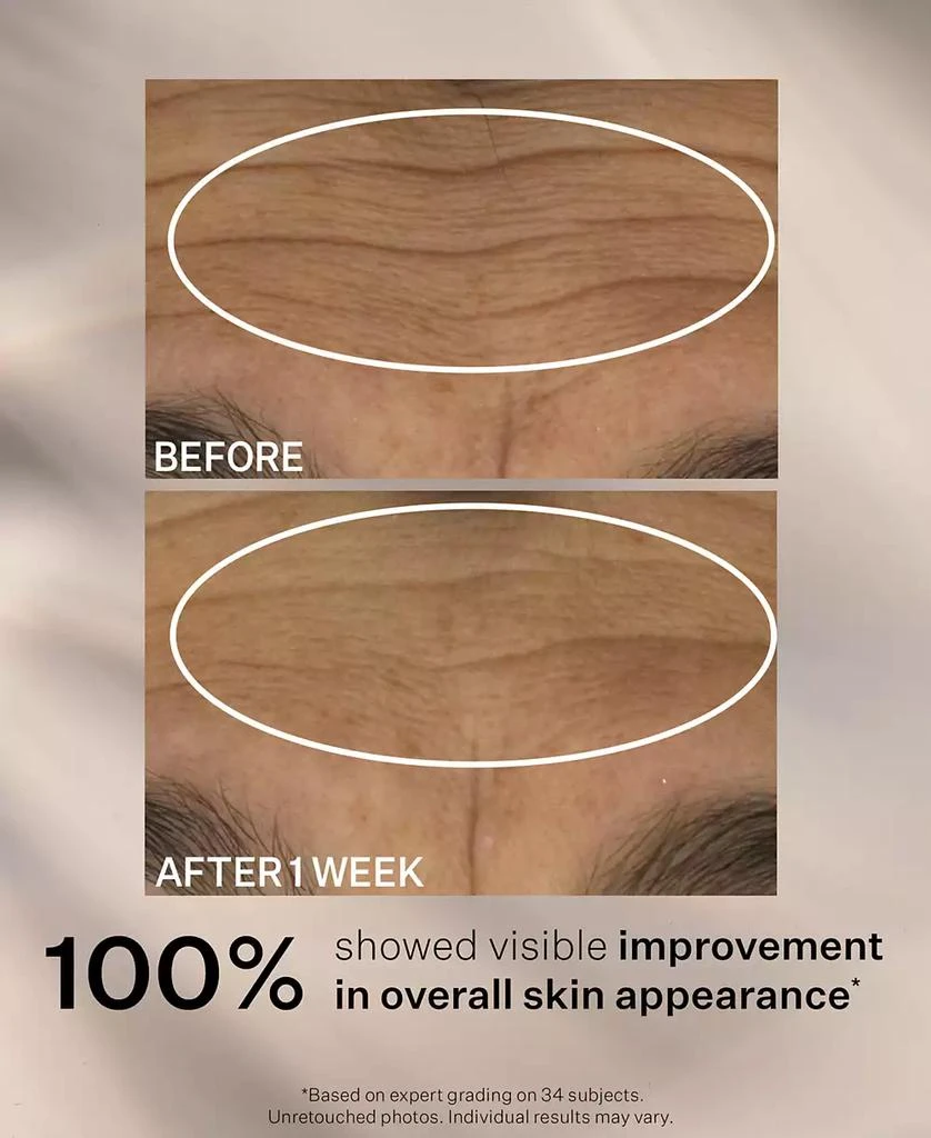 StriVectin Wrinkle Recode Moisture Rich Barrier Cream, 1.7-oz. 6