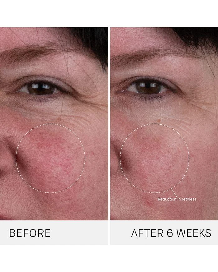 Augustinus Bader The Rich Cream 6