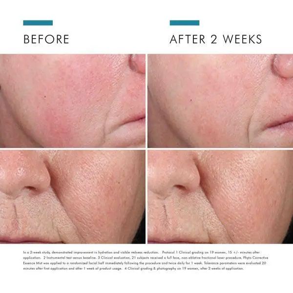 SkinCeuticals SkinCeuticals Phyto Corrective Essence Facial Mist (1.7 fl. oz.) 5
