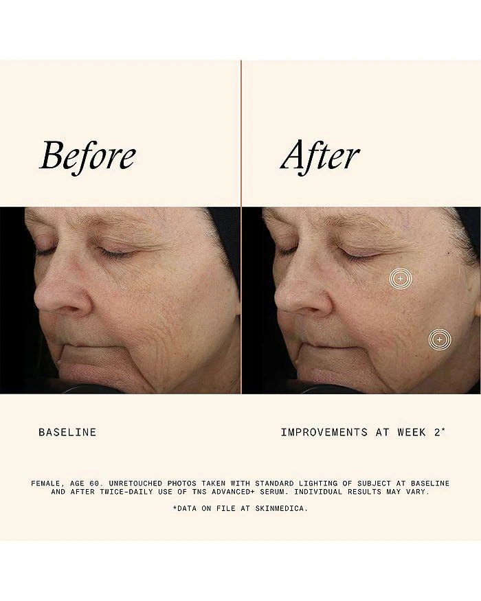 SkinMedica TNS Advanced+ Serum 1 oz. 7