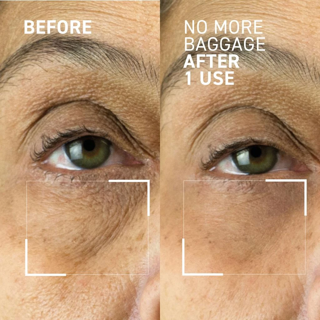 Dr. Brandt Skincare Dr. Brandt Needles No More No More Baggage Eye Gel 15g 3