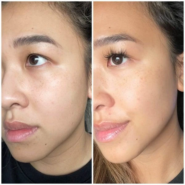 Ameliorate AMELIORATE Resurfacing Facial Mask 5