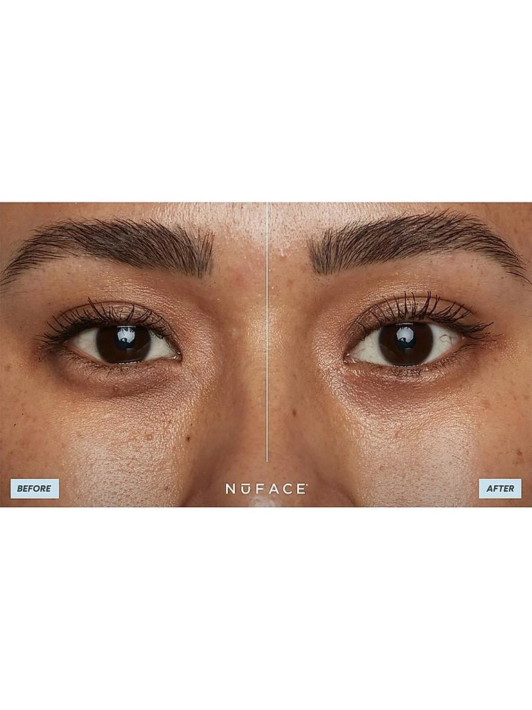 NuFace IonPlex HydraGel Power Patches 2