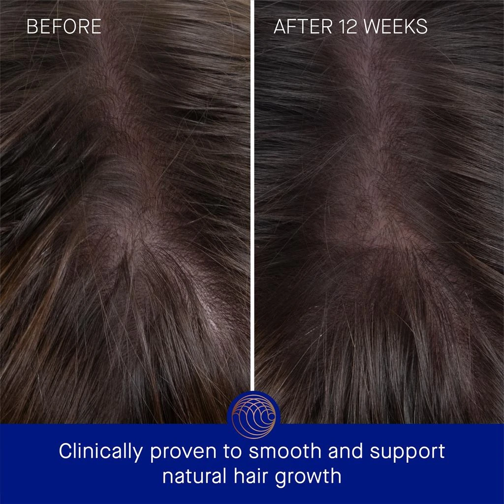 Augustinus Bader Augustinus Bader The Hair Oil with TCF8 4