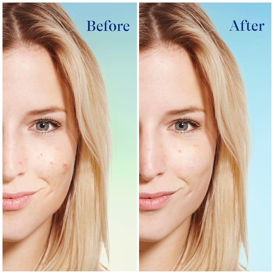 Differin Daily Deep Cleanser