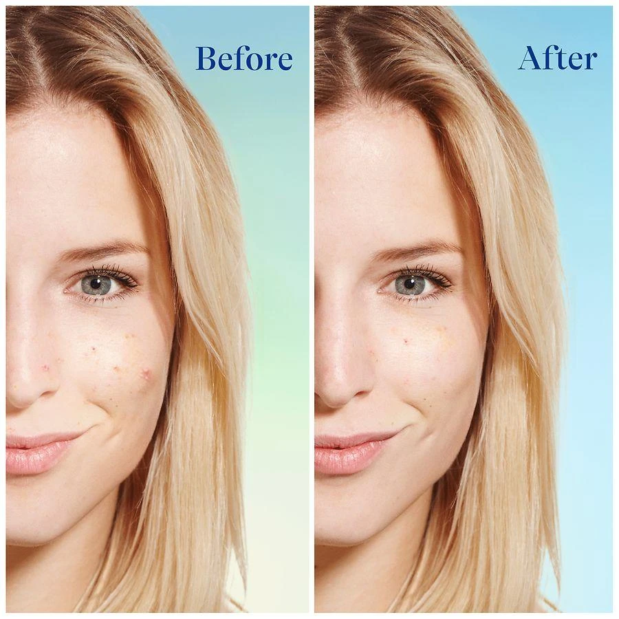 Differin 5% Benzoyl Peroxide Daily Deep Cleanser 2
