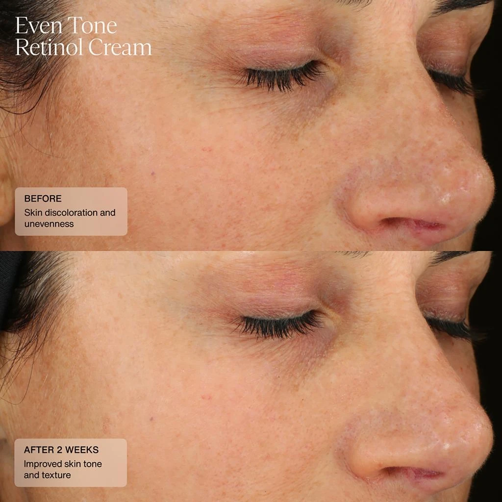 SENTÉ SENTÉ Even Tone Retinol Cream 30ml 4