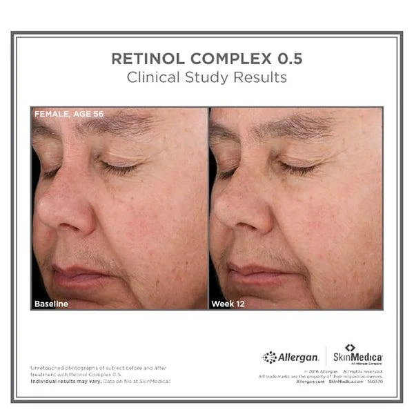 SkinMedica SkinMedica LYTERA 2.0 Pigment Correcting Serum and Retinol Complex 0.5 (Worth $231) 2