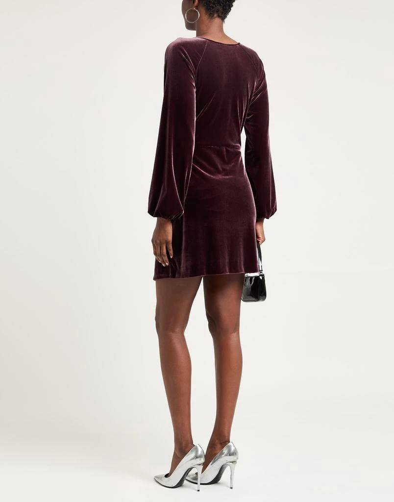 SOALLURE Short dress 3