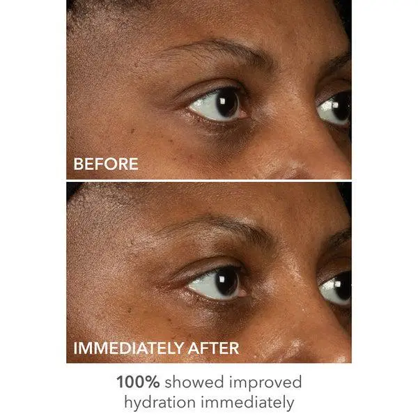 Dr. Dennis Gross Dr. Dennis Gross DermInfusions Lift and Repair Eye Mask, 1 Treatment 6