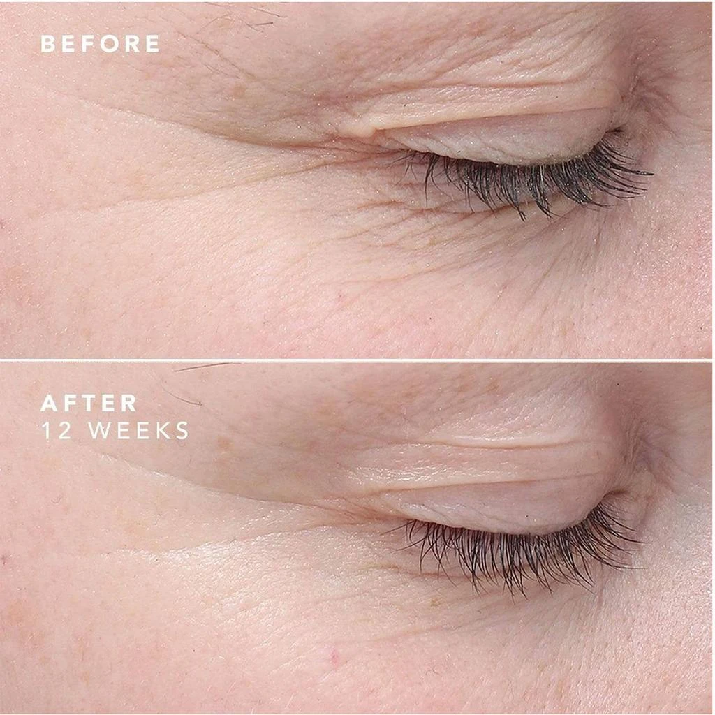 Bioeffect BIOEFFECT EGF Eye Serum 6ml 7