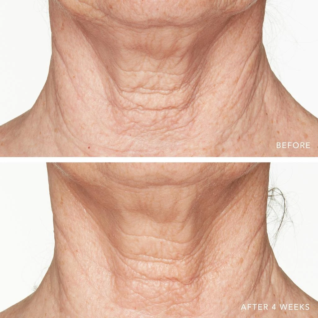 Lancer Skincare Lancer Skincare Advanced Retinol Treatment with 1.25 Retinol 7