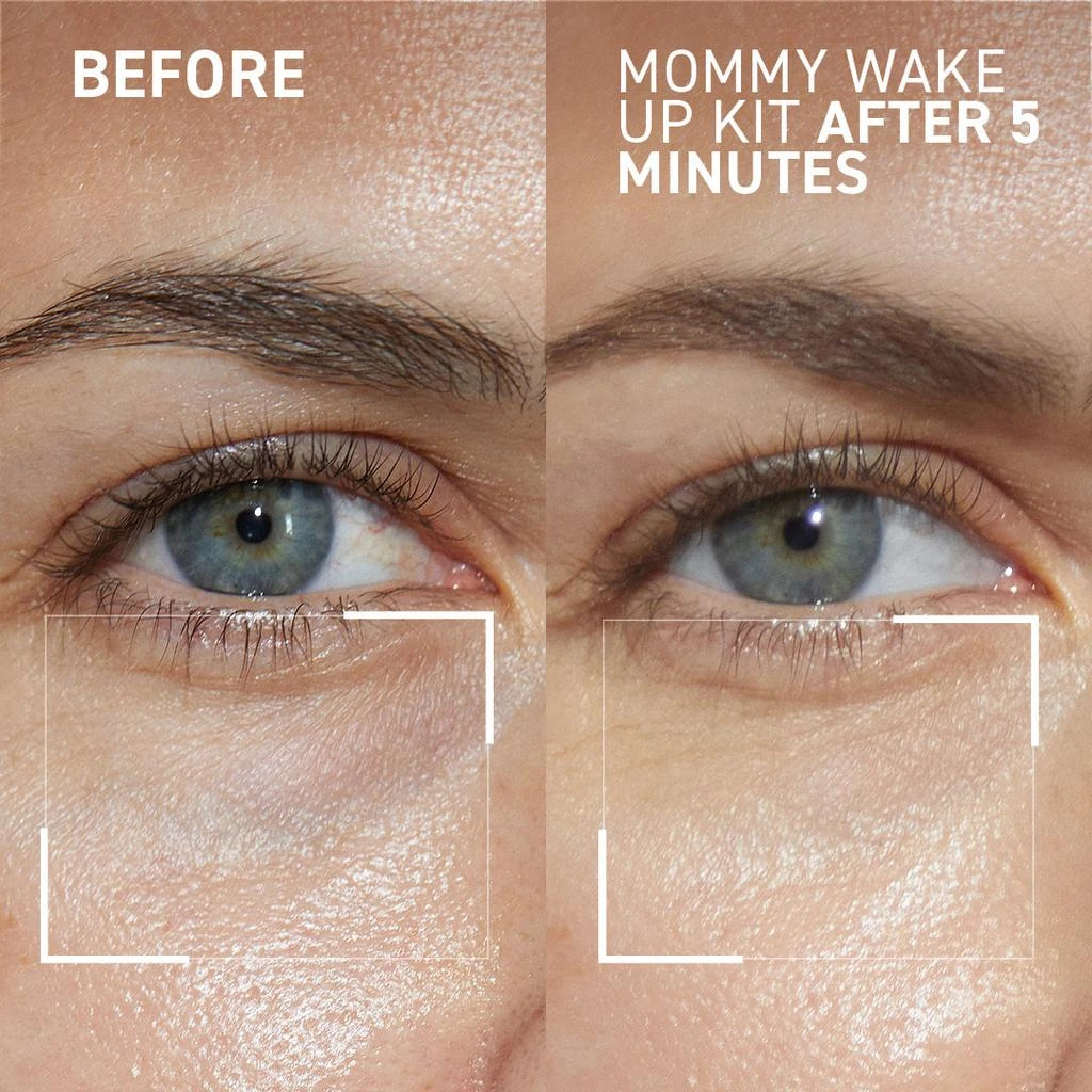 Dr. Brandt Skincare Mommy Wake Up Kit 10