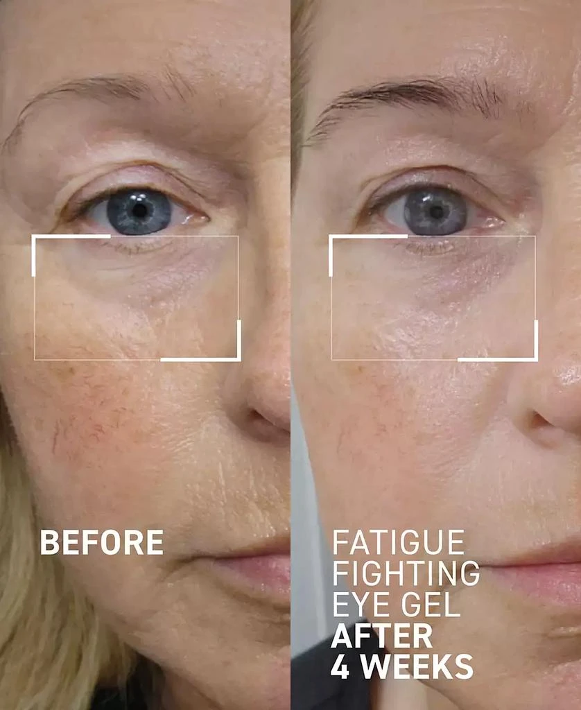 Dr. Brandt Skincare Fatigue Fighting Eye Gel, 0.5 oz. 7