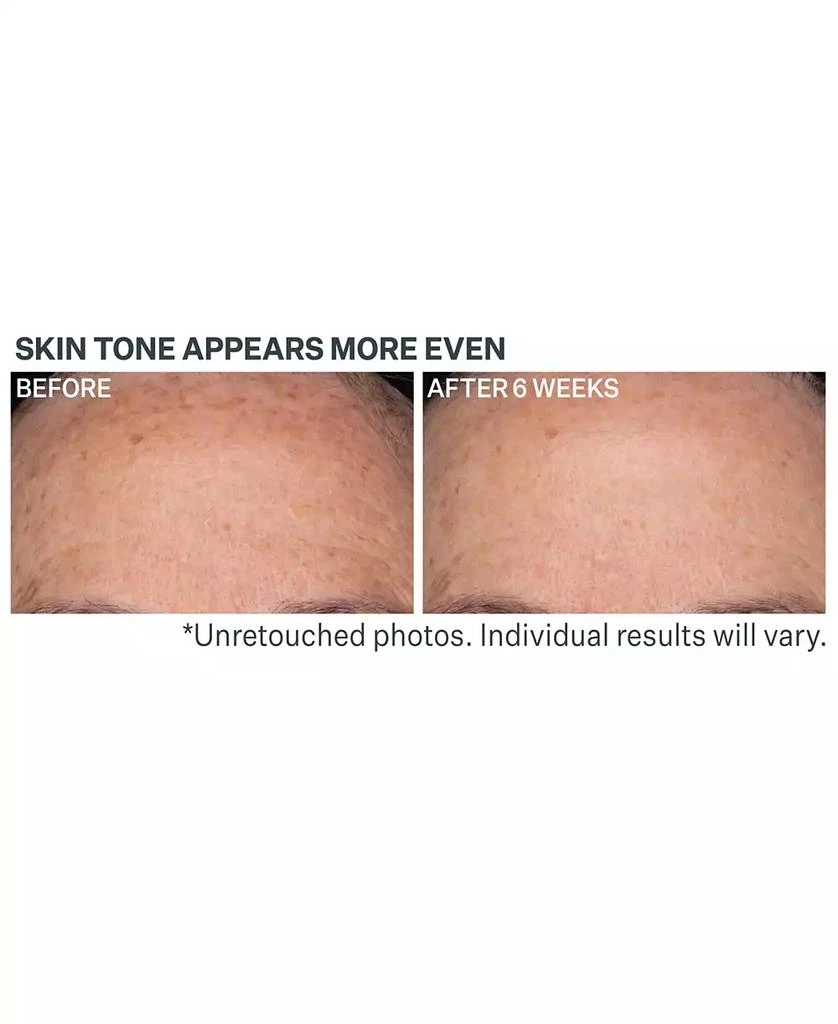 StriVectin Advanced Retinol Daily Repair Moisturizer SPF 30 5