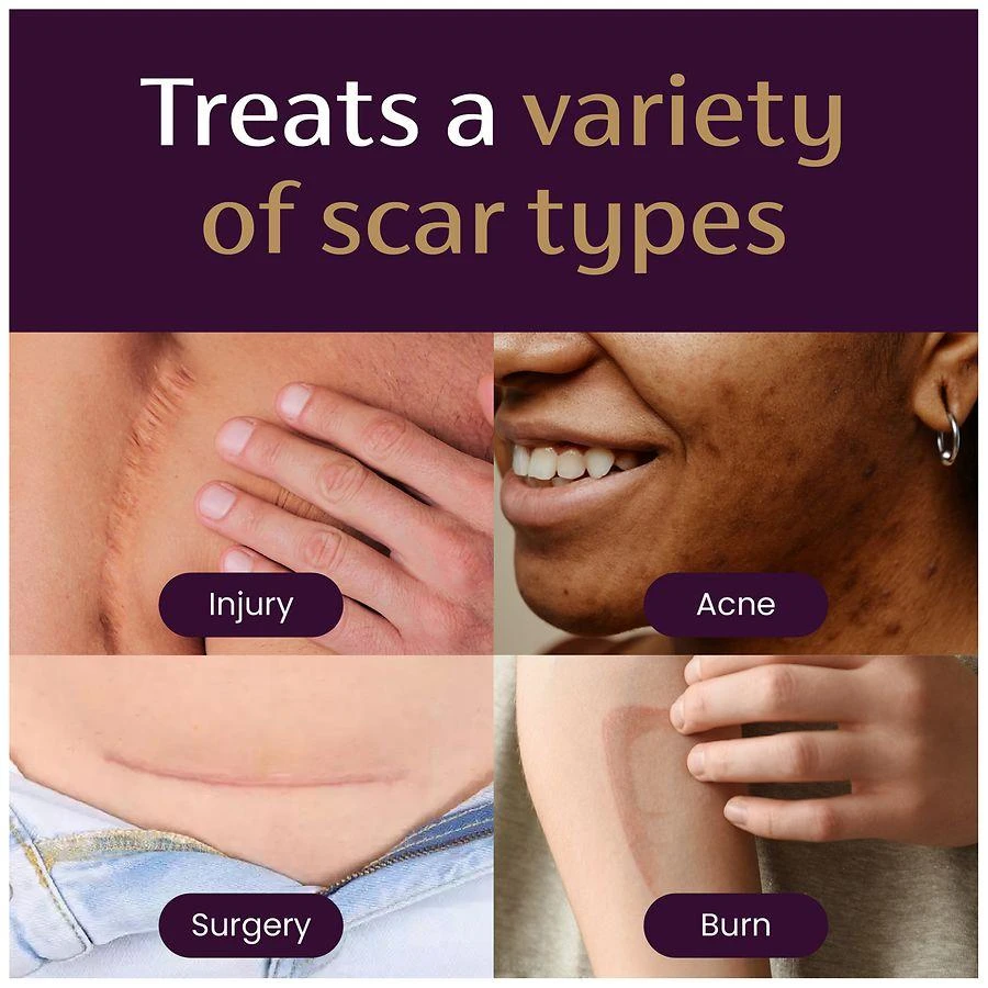 Mederma PM Intensive Overnight Scar Cream Treatment 5