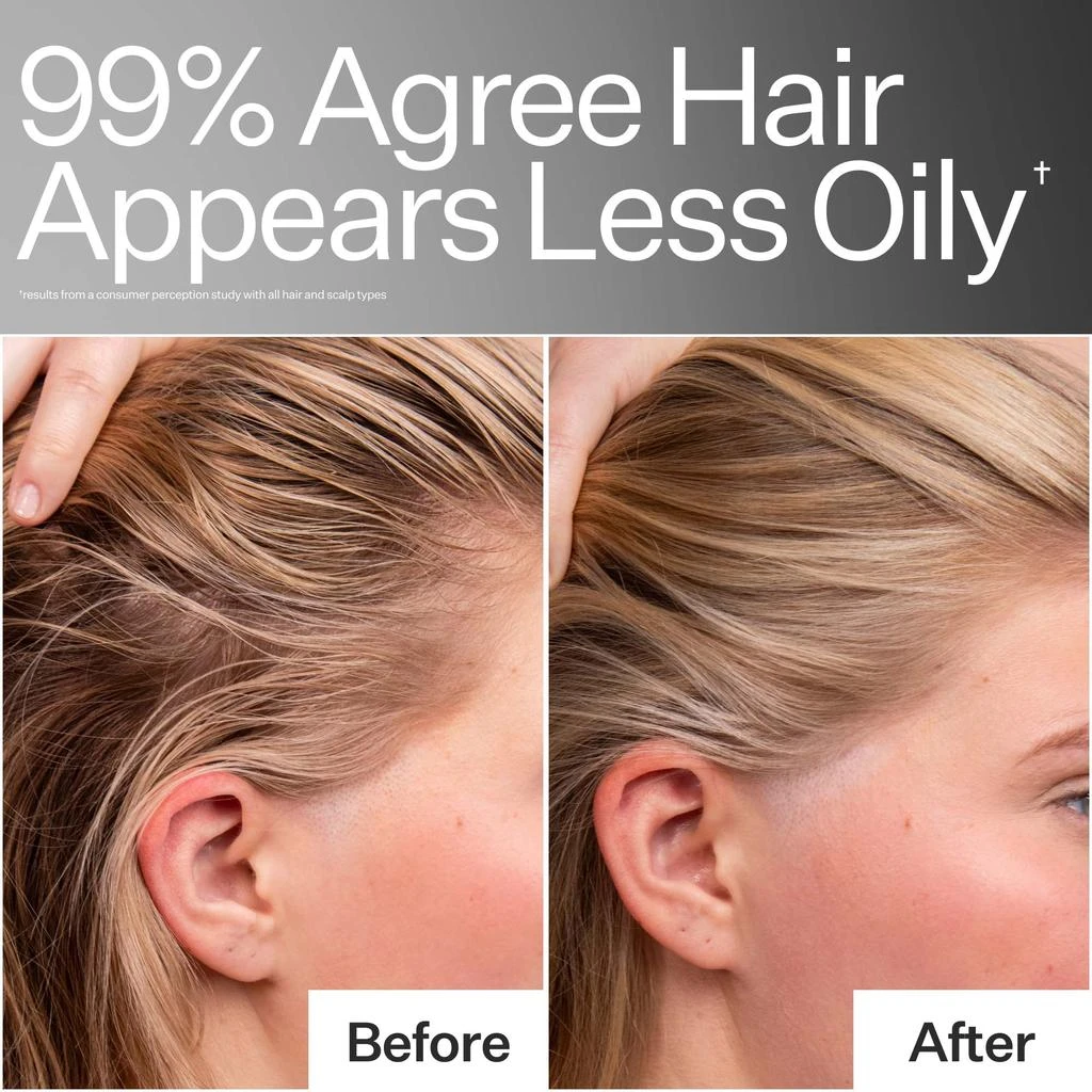Act+Acre Act+Acre 4% Niacinamide Oily Scalp Serum 2.2 oz 8