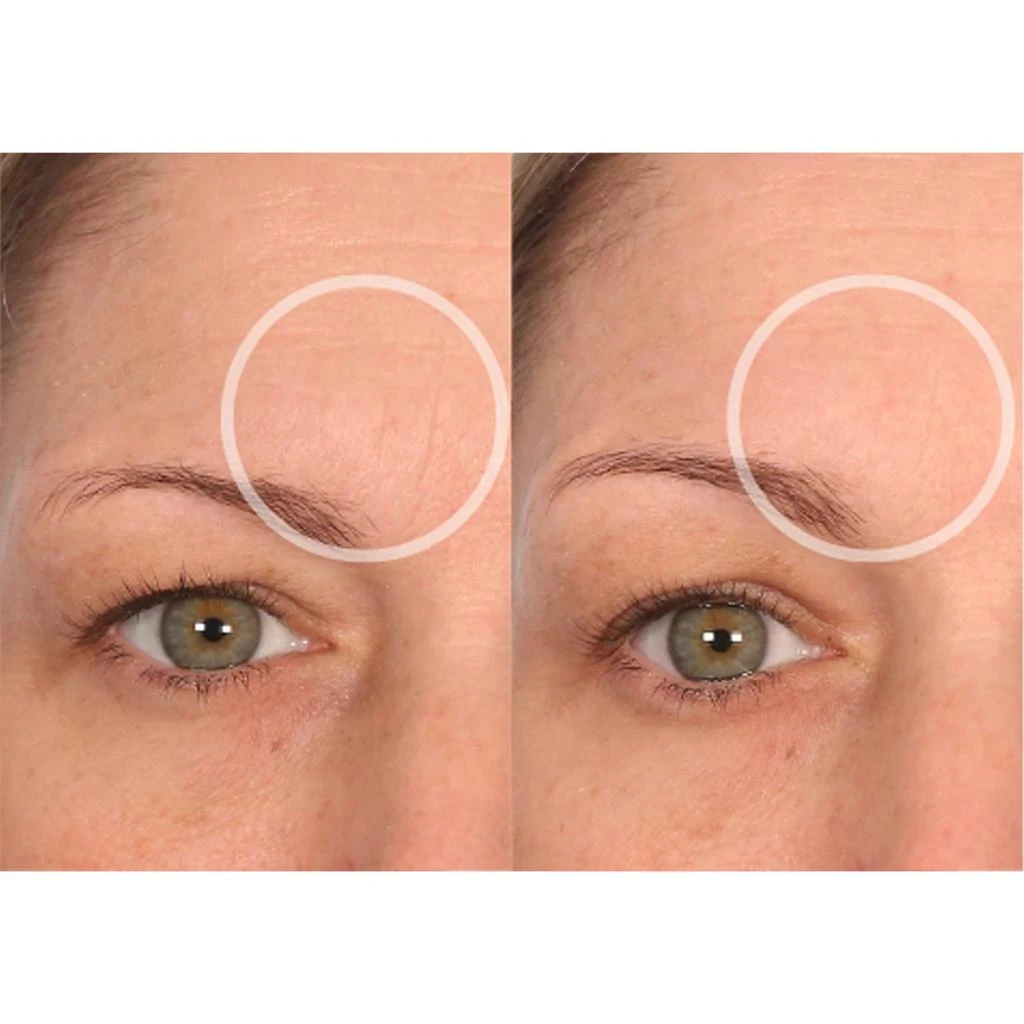 SIO Beauty SiO Beauty Browlift Patch 5