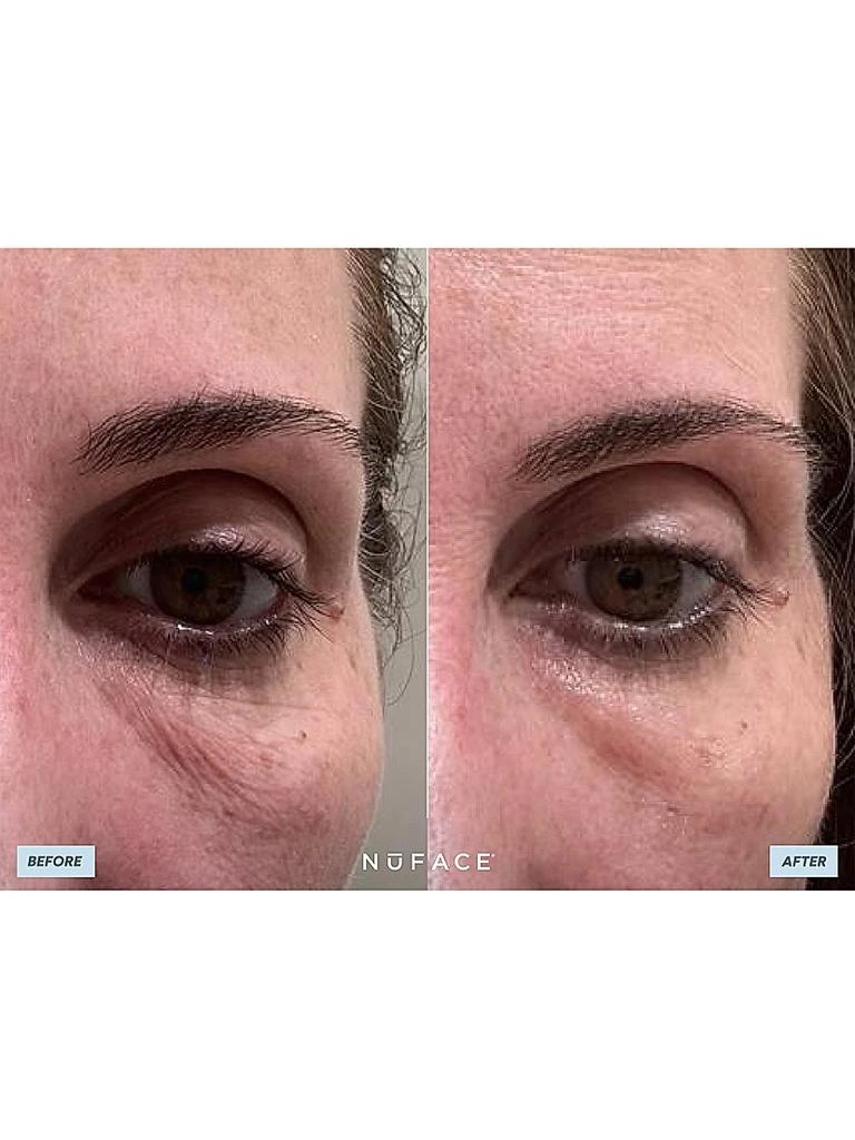 NuFace IonPlex HydraGel Power Patches 3