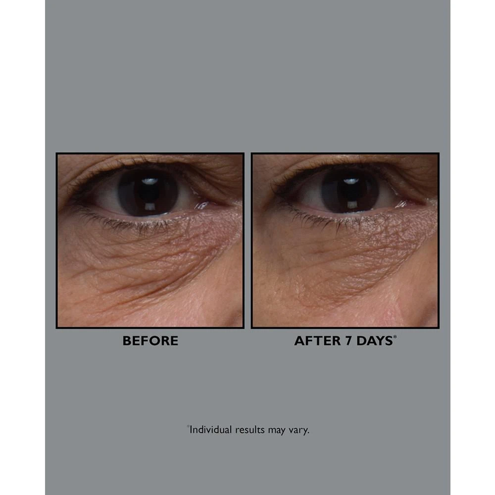 Peter Thomas Roth FIRMx Collagen Eye Cream 3