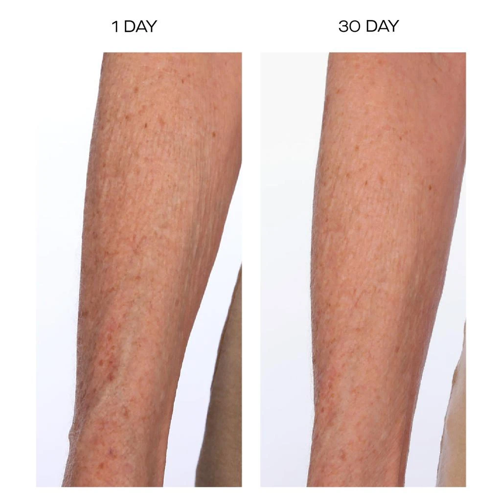 U Beauty The Sculpt Arm Compound 4