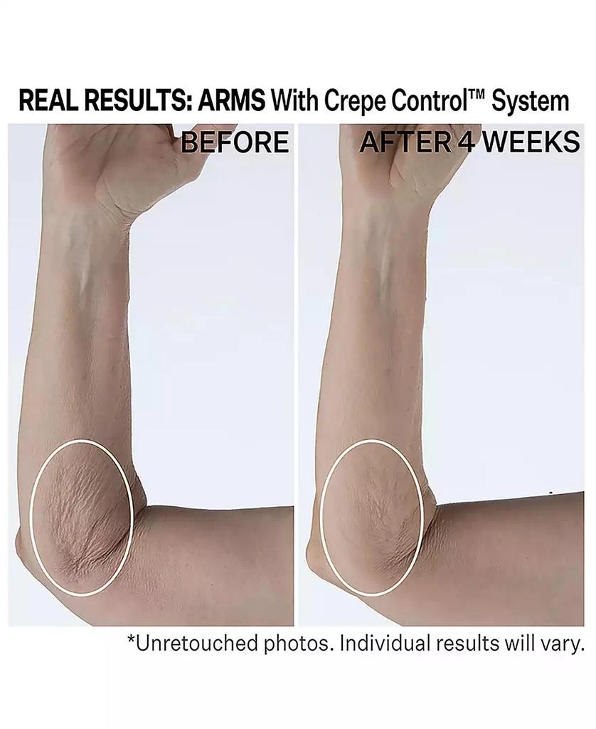 StriVectin Crepe Control Tightening Body Cream, 6.7 oz 3