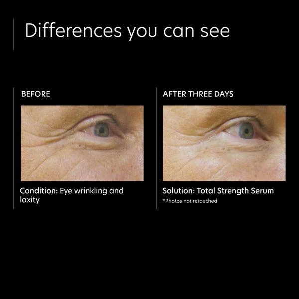 PCA SKIN PCA SKIN Total Strength Serum 4
