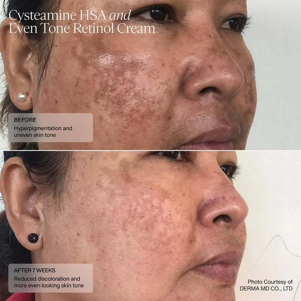 SENTÉ SENTÉ Even Tone Retinol Cream 30ml 5