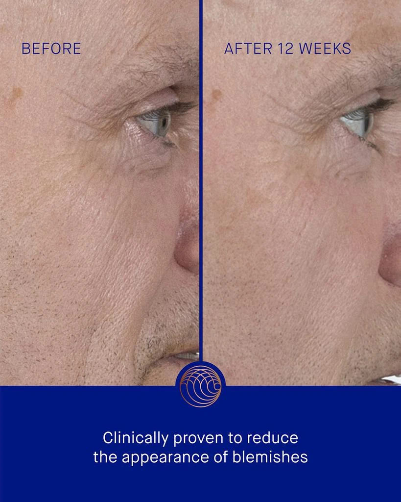 Augustinus Bader The Serum with TFC8®, 1.7 oz. 5