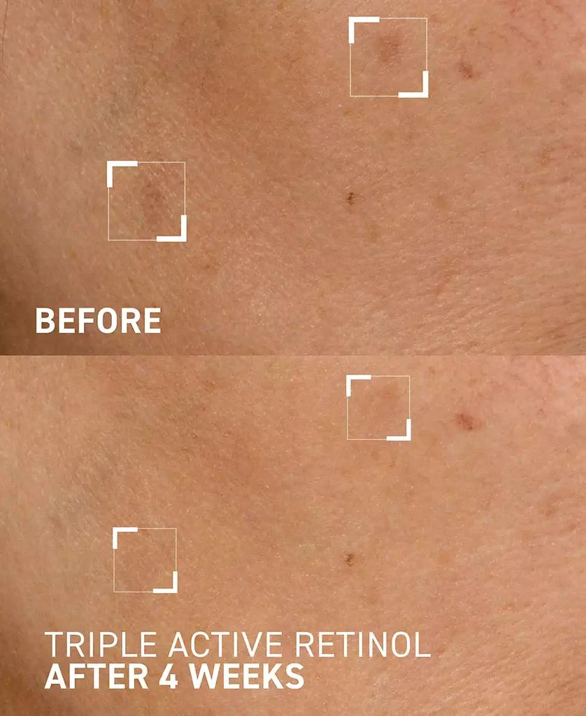 Dr. Brandt Skincare Triple Active Retinol Gentle Overnight Renewal Cream, 1 oz. 2