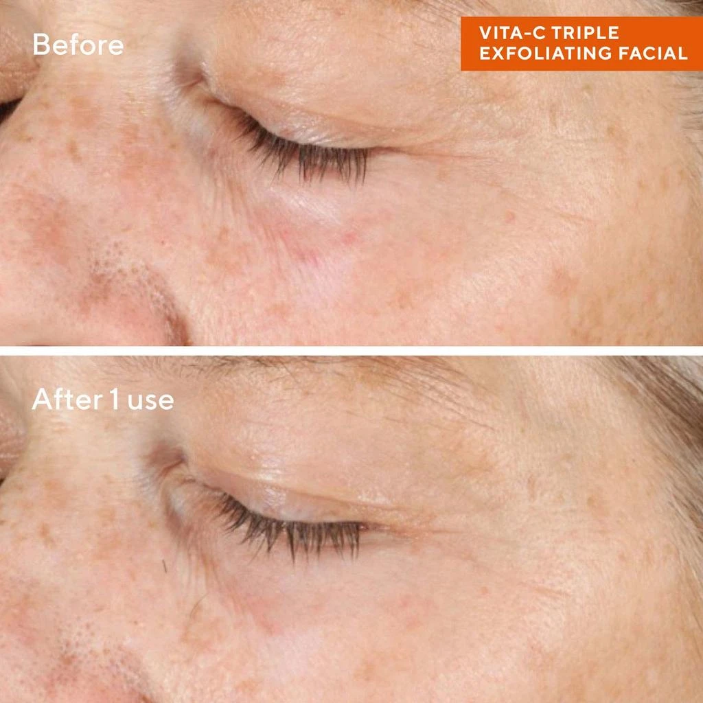 Murad Murad Vitamin C Triple Exfoliating Facial Peel 2.7 fl. Oz 3